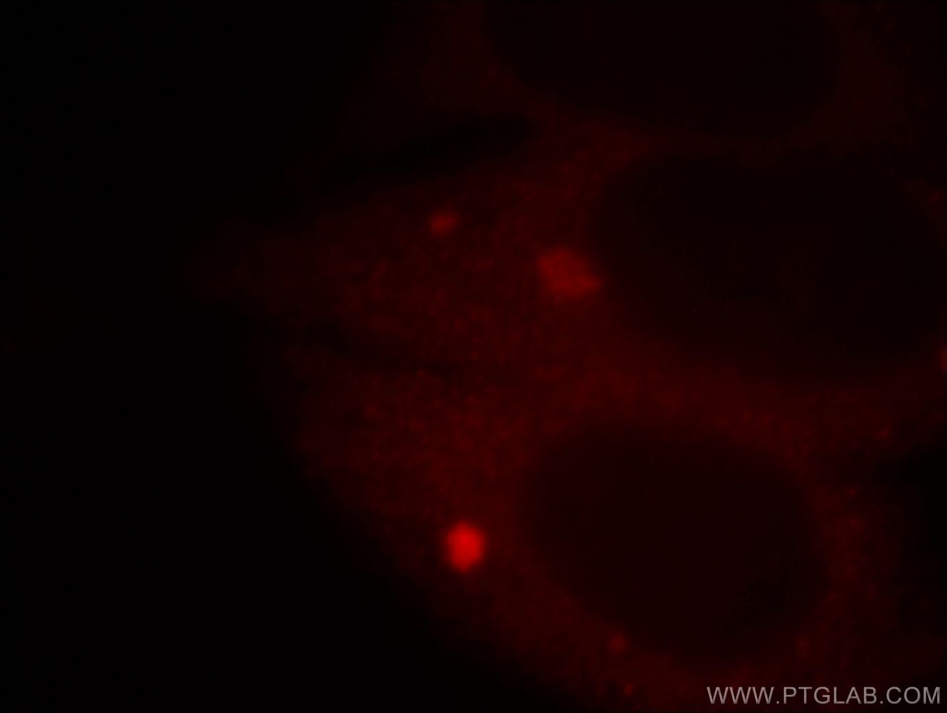 Immunofluorescence (IF) / fluorescent staining of HepG2 cells using APPL1 Polyclonal antibody (19885-1-AP)