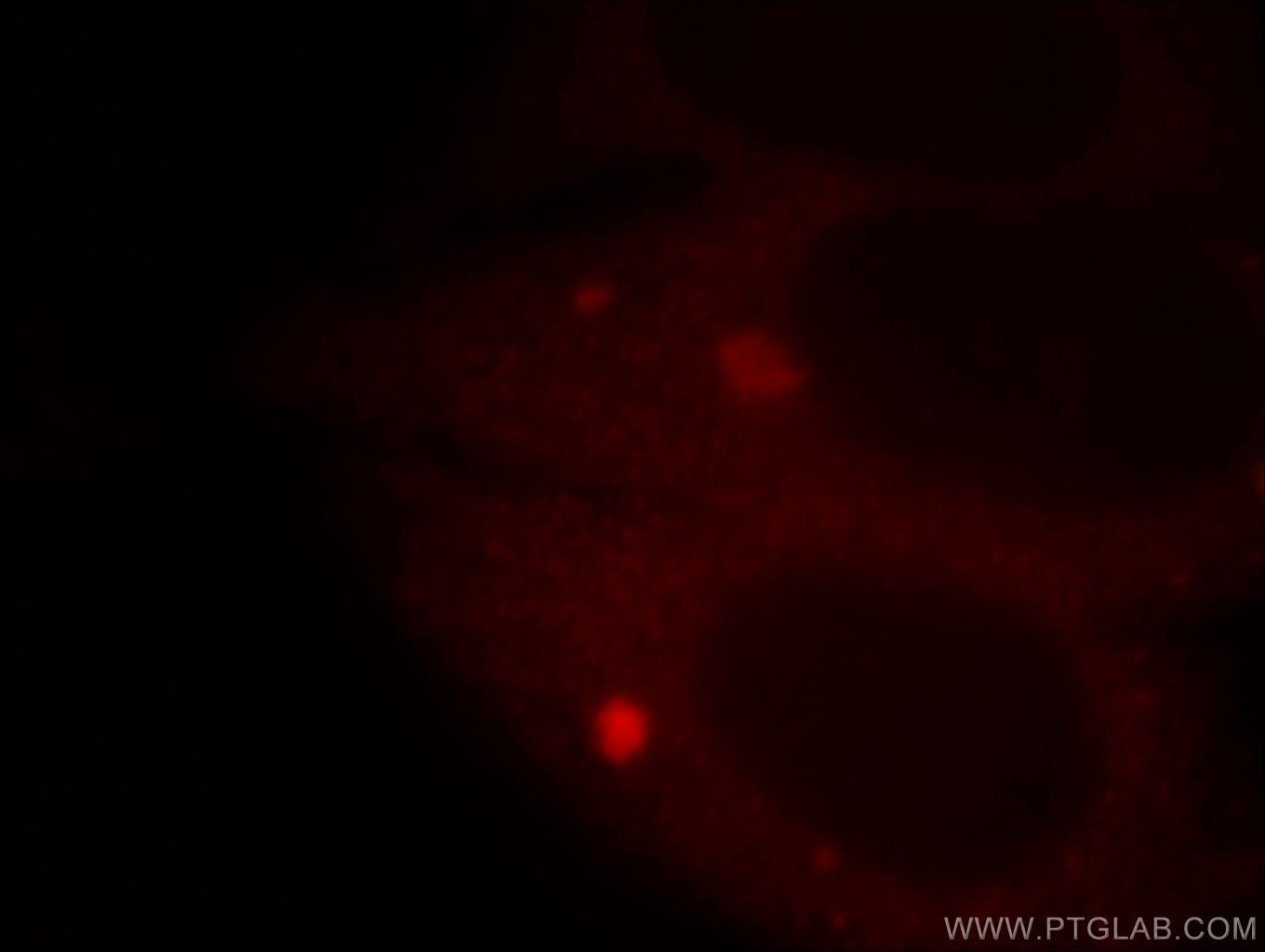 IF Staining of HepG2 using 19885-1-AP