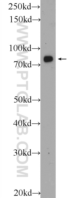 Western Blot (WB) analysis of mouse brain tissue using APPL1 Polyclonal antibody (19885-1-AP)