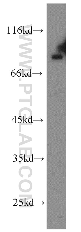 Western Blot (WB) analysis of HEK-293 cells using APPL1 Polyclonal antibody (19885-1-AP)