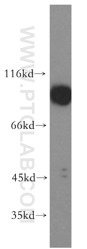 Western Blot (WB) analysis of human brain tissue using APPL1 Polyclonal antibody (19885-1-AP)