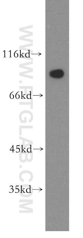 Western Blot (WB) analysis of HeLa cells using APPL1 Polyclonal antibody (19885-1-AP)