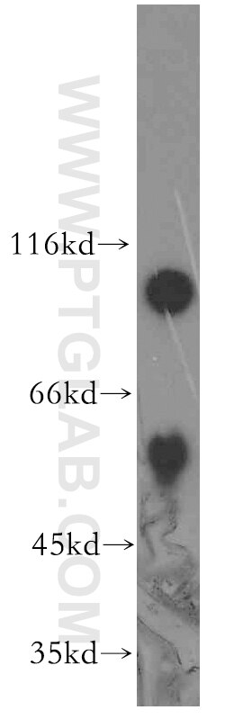 Western Blot (WB) analysis of human heart tissue using APPL1 Polyclonal antibody (19885-1-AP)