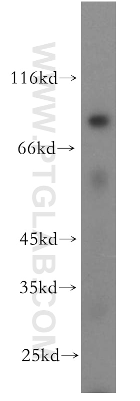 Western Blot (WB) analysis of HT-1080 cells using APPL1 Polyclonal antibody (19885-1-AP)