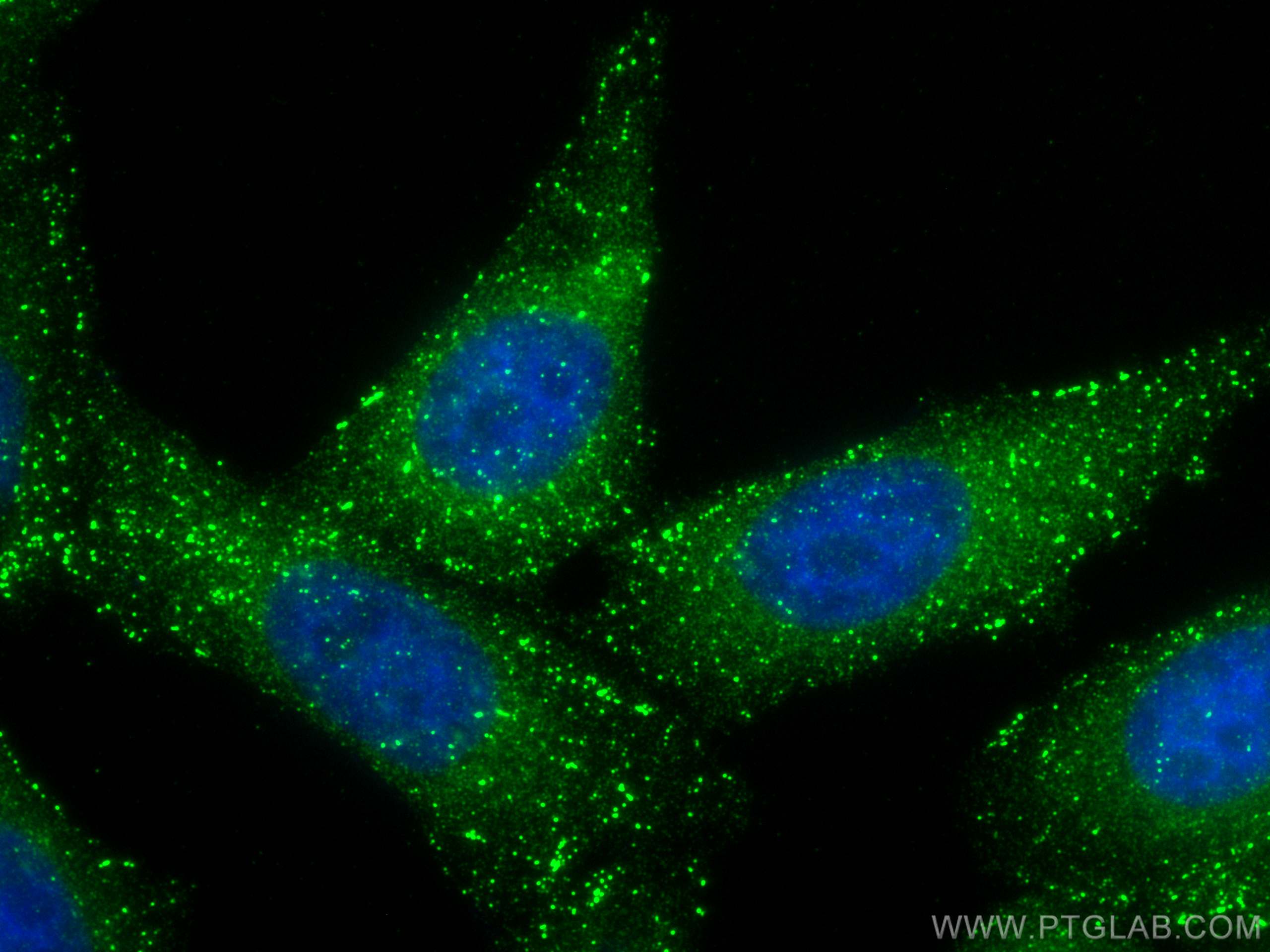 Immunofluorescence (IF) / fluorescent staining of HepG2 cells using APPL1 Monoclonal antibody (68195-1-Ig)