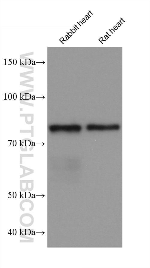 Western Blot (WB) analysis of various lysates using APPL1 Monoclonal antibody (68195-1-Ig)