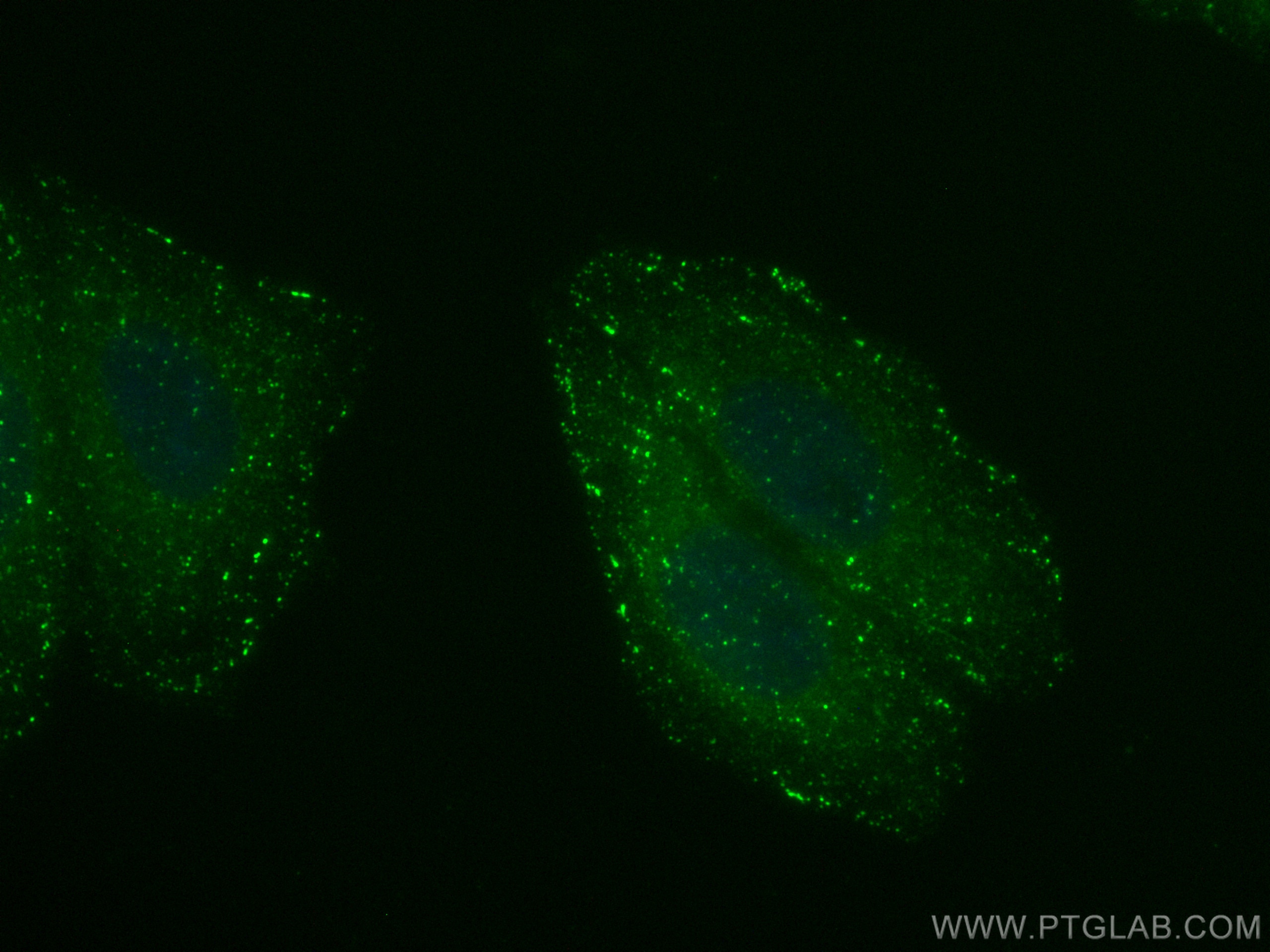 Immunofluorescence (IF) / fluorescent staining of HepG2 cells using CoraLite® Plus 488-conjugated APPL1 Polyclonal ant (CL488-12639)