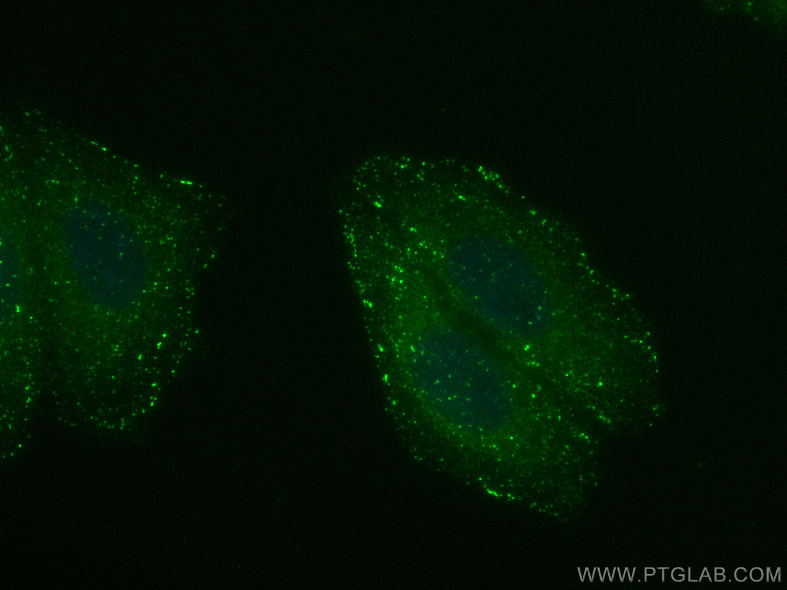 Immunofluorescence (IF) / fluorescent staining of HepG2 cells using CoraLite® Plus 488-conjugated APPL1 Polyclonal ant (CL488-12639)