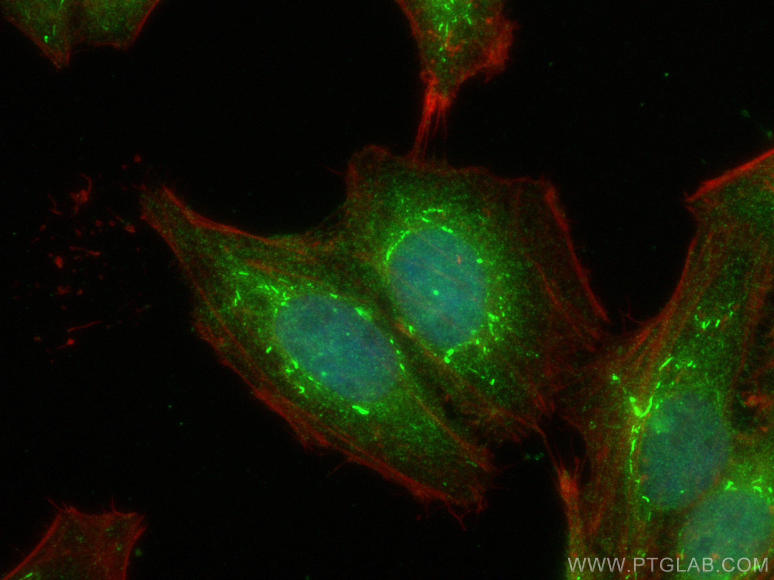 Immunofluorescence (IF) / fluorescent staining of HepG2 cells using CoraLite® Plus 488-conjugated APPL1 Polyclonal ant (CL488-19885)