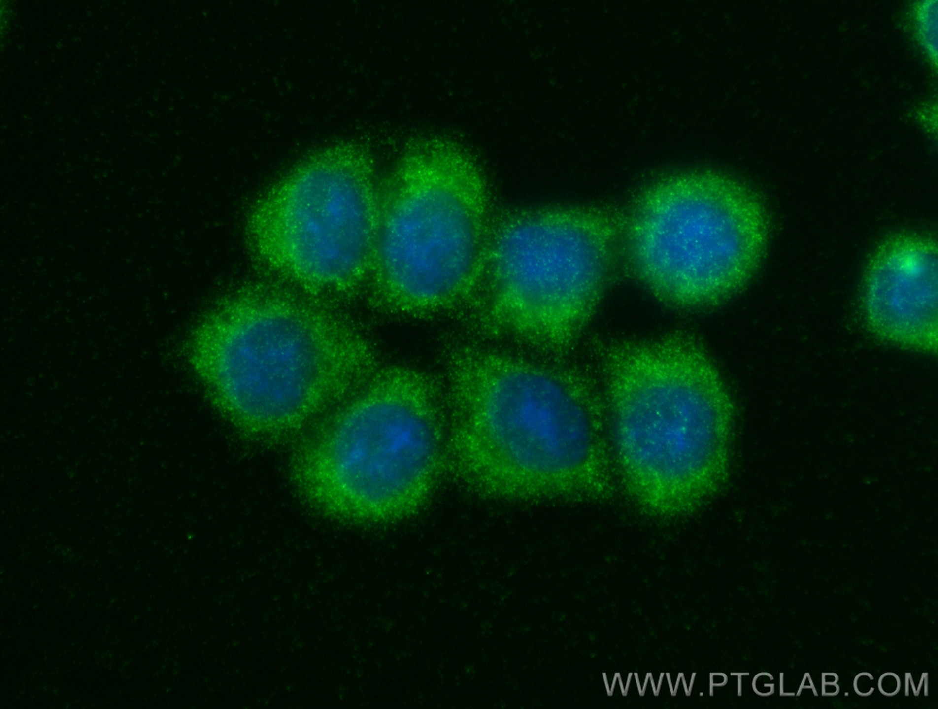 Immunofluorescence (IF) / fluorescent staining of BxPC-3 cells using APPL2 Polyclonal antibody (14294-1-AP)