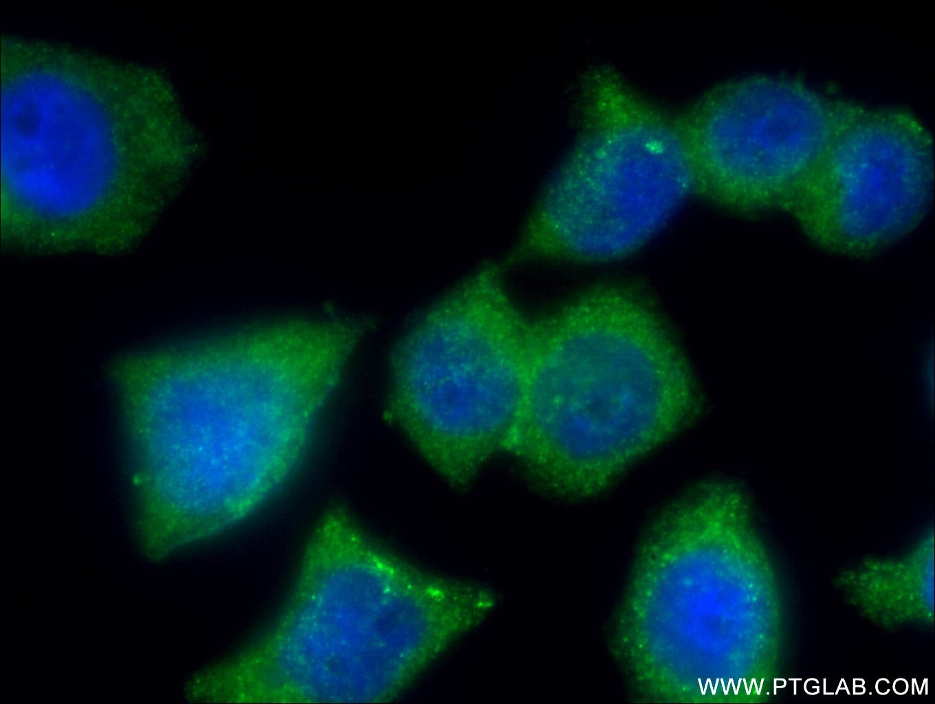 Immunofluorescence (IF) / fluorescent staining of BxPC-3 cells using APPL2 Polyclonal antibody (14294-1-AP)