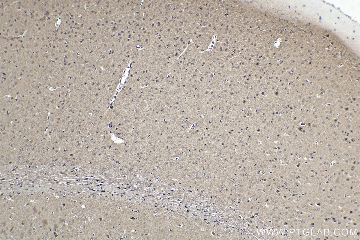 Immunohistochemistry (IHC) staining of mouse brain tissue using APPL2 Polyclonal antibody (14294-1-AP)