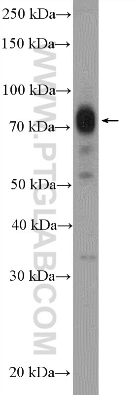 Western Blot (WB) analysis of BxPC-3 cells using APPL2 Polyclonal antibody (14294-1-AP)