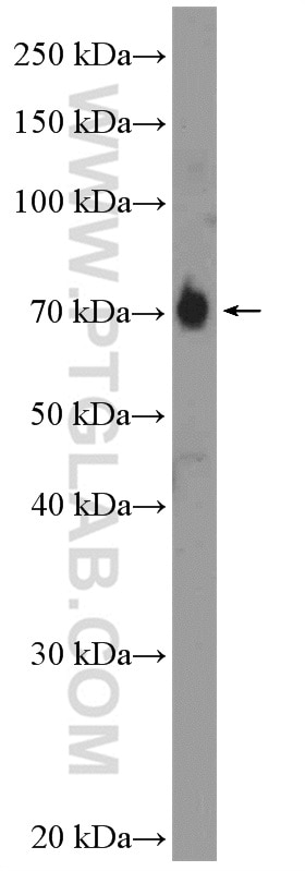 Western Blot (WB) analysis of BxPC-3 cells using APPL2 Polyclonal antibody (14294-1-AP)