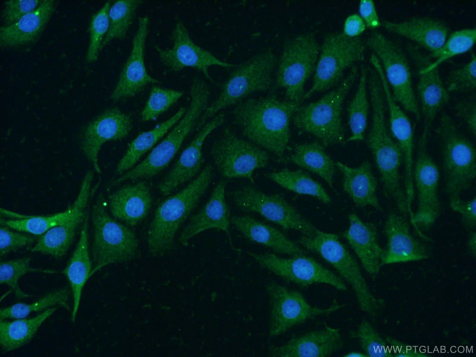Immunofluorescence (IF) / fluorescent staining of SH-SY5Y cells using TNFSF13 Polyclonal antibody (10680-1-AP)