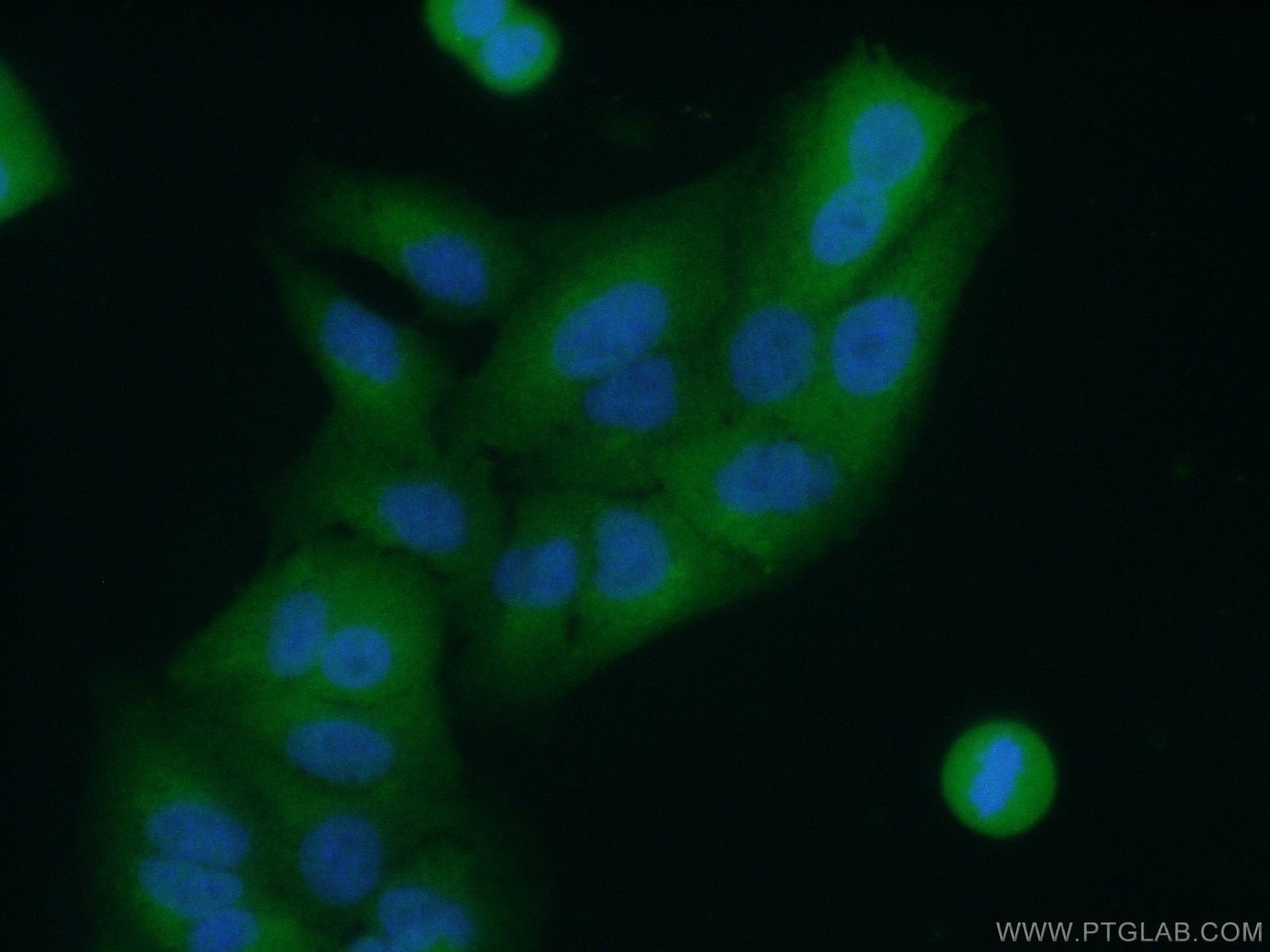 Immunofluorescence (IF) / fluorescent staining of A549 cells using APRT Polyclonal antibody (21405-1-AP)