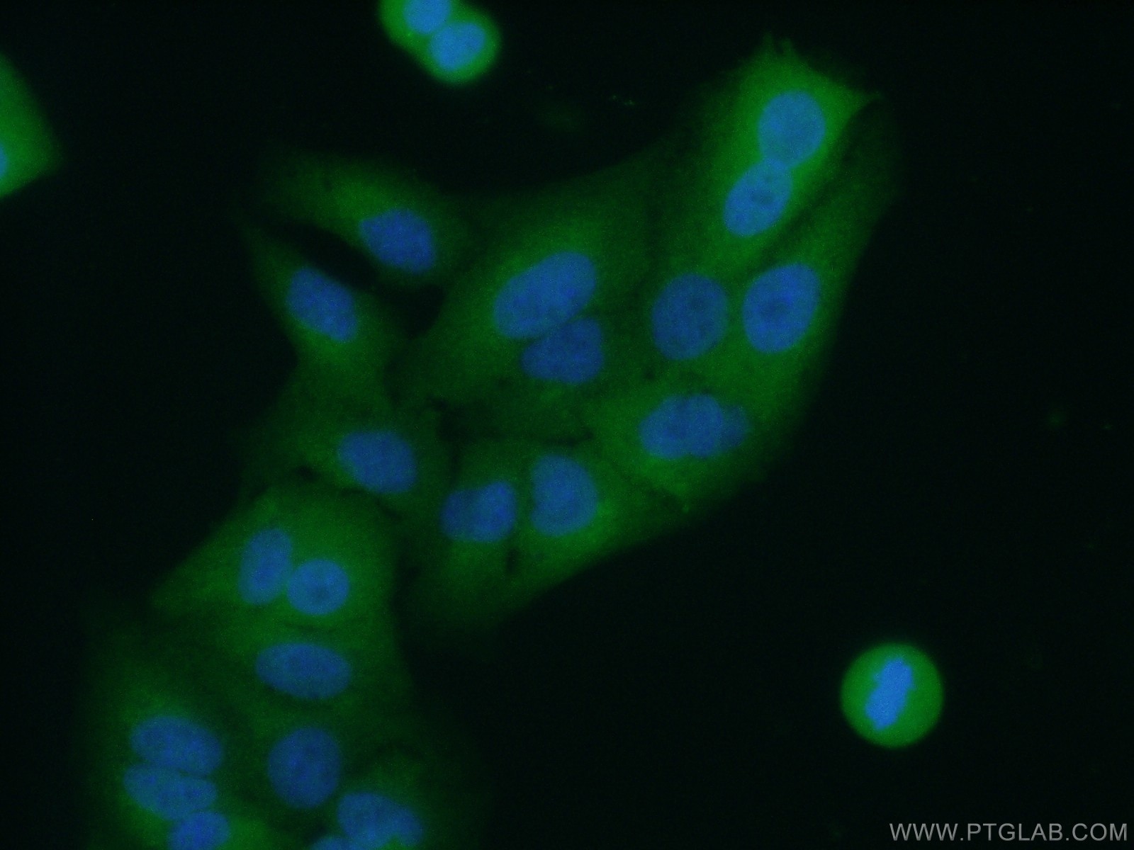 IF Staining of A549 using 21405-1-AP