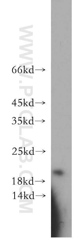 Western Blot (WB) analysis of A549 cells using APRT Polyclonal antibody (21405-1-AP)