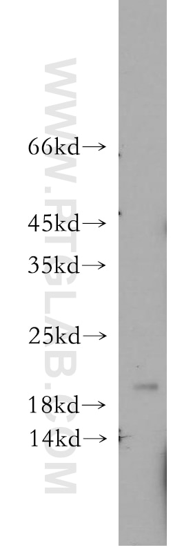 Western Blot (WB) analysis of A431 cells using APRT Polyclonal antibody (21405-1-AP)