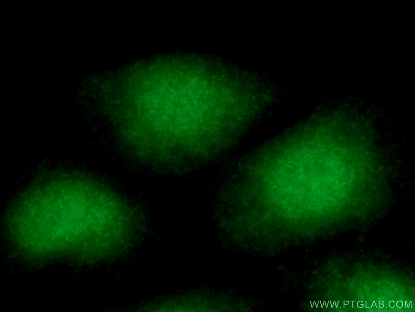 Immunofluorescence (IF) / fluorescent staining of HepG2 cells using APTX Polyclonal antibody (26747-1-AP)