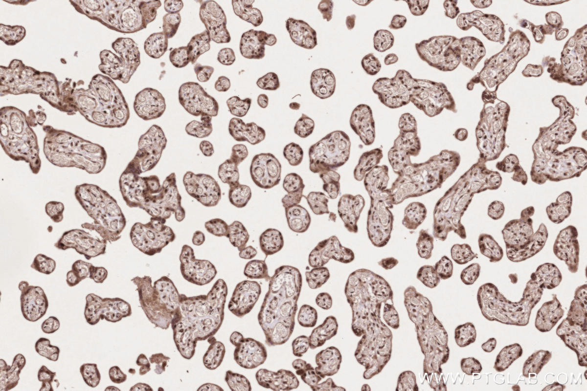 Immunohistochemistry (IHC) staining of human placenta tissue using APTX Polyclonal antibody (26747-1-AP)