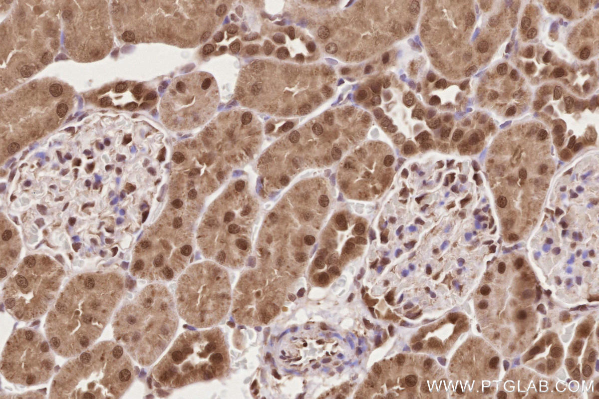 Immunohistochemistry (IHC) staining of rat kidney tissue using APTX Polyclonal antibody (26747-1-AP)