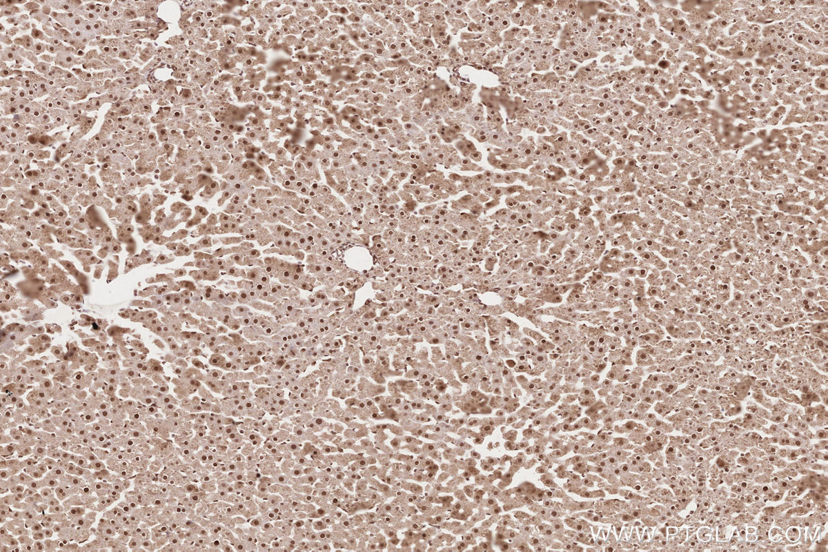 Immunohistochemistry (IHC) staining of rat liver tissue using APTX Polyclonal antibody (26747-1-AP)