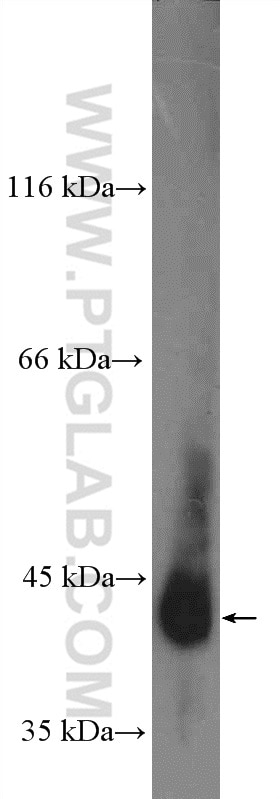 Western Blot (WB) analysis of HEK-293T cells using APTX Polyclonal antibody (26747-1-AP)