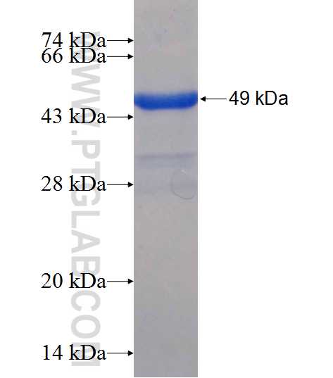 APTX fusion protein Ag24945 SDS-PAGE