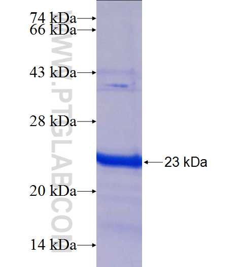 APTX fusion protein Ag25172 SDS-PAGE