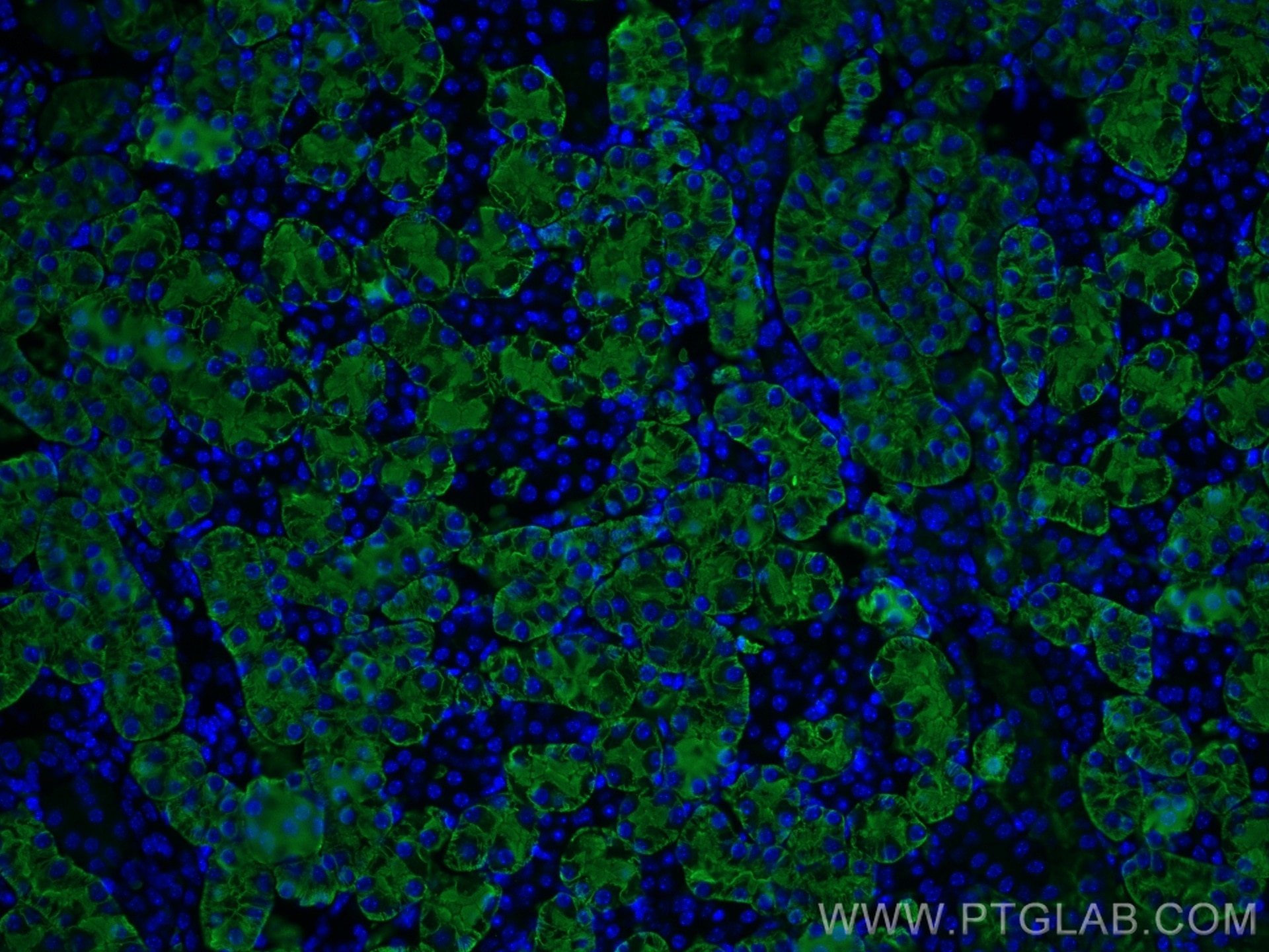 Immunofluorescence (IF) / fluorescent staining of mouse kidney tissue using AQP1 Polyclonal antibody (20333-1-AP)