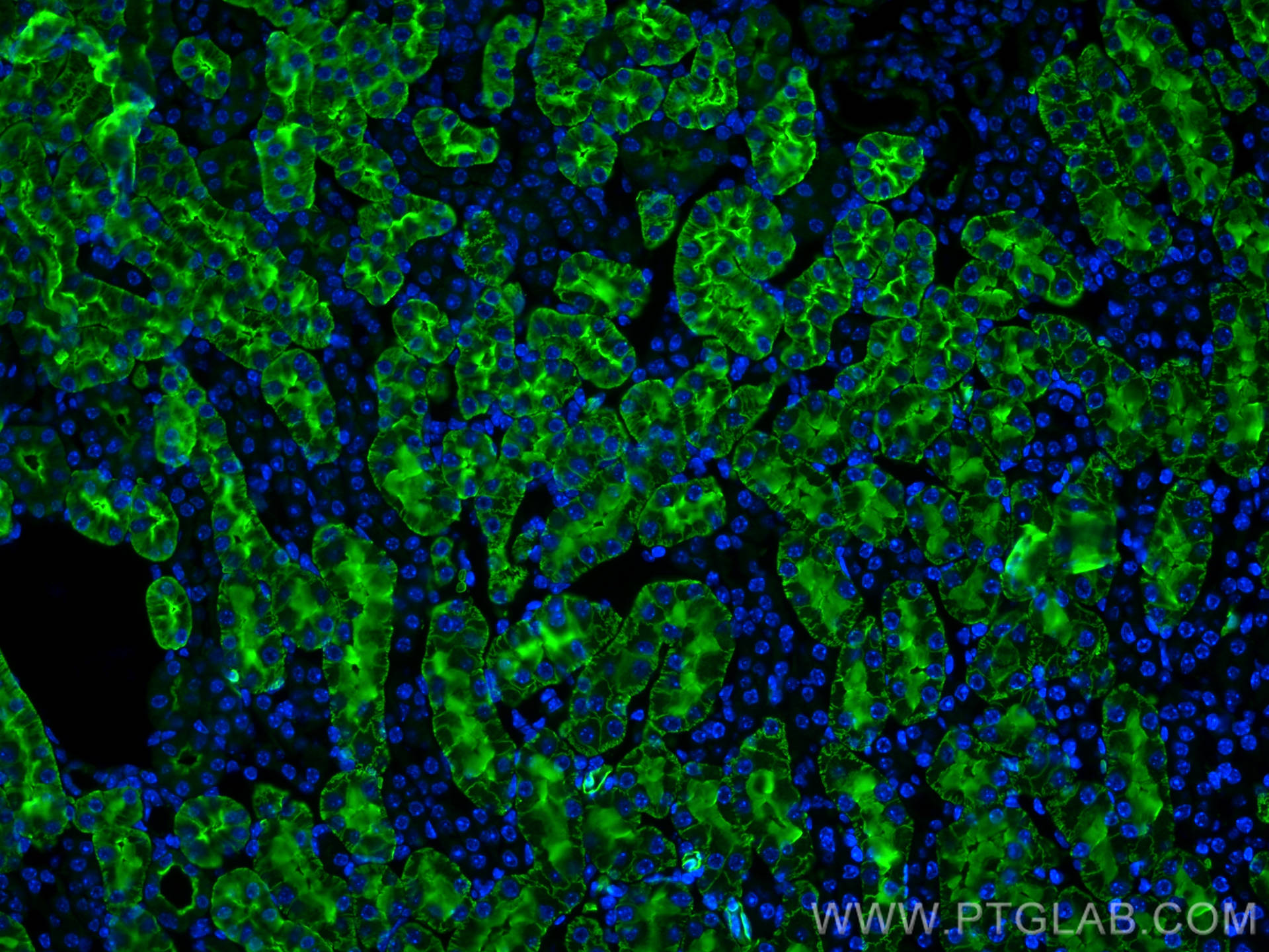 Immunofluorescence (IF) / fluorescent staining of mouse kidney tissue using AQP1 Polyclonal antibody (20333-1-AP)