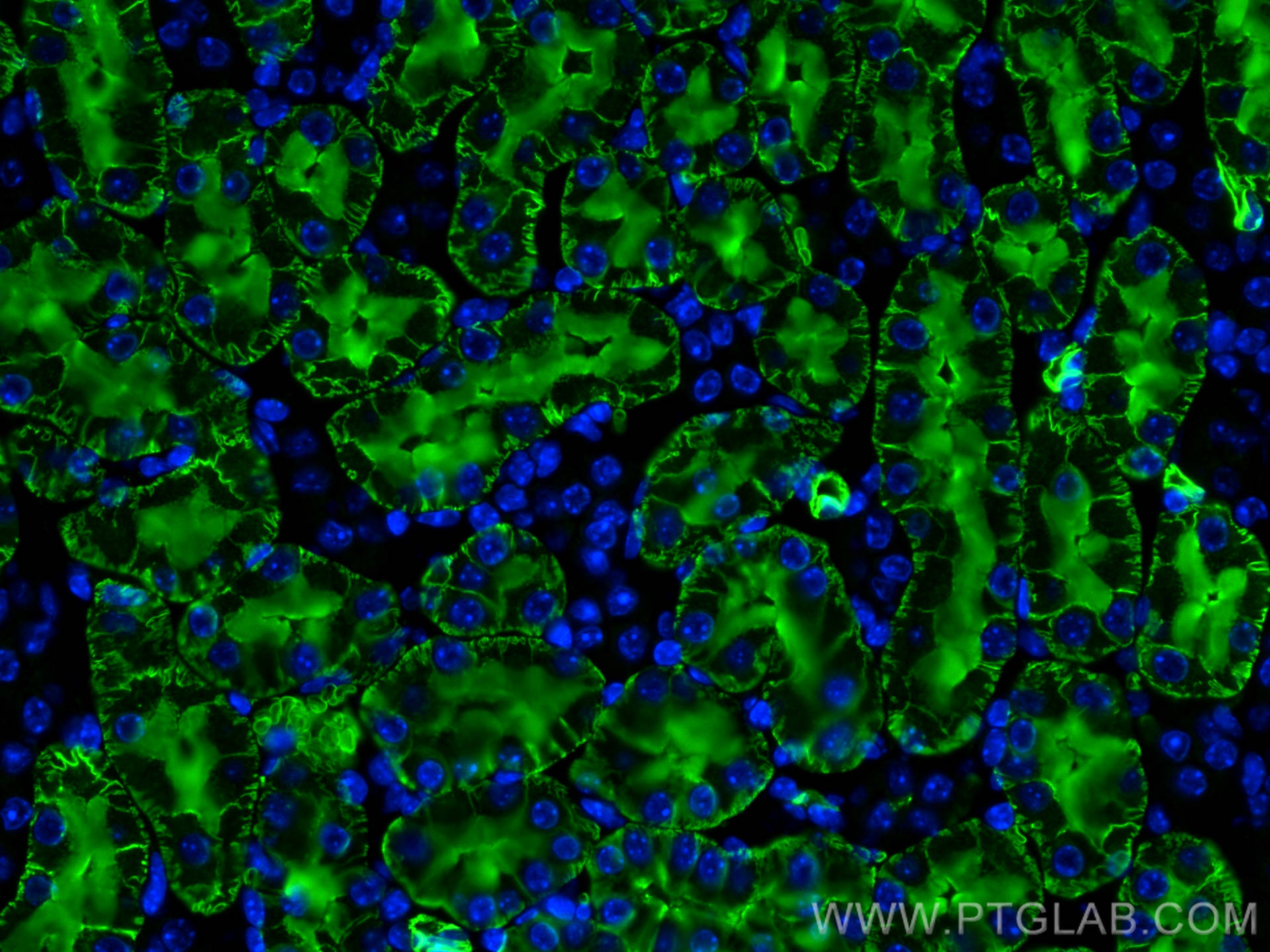 Immunofluorescence (IF) / fluorescent staining of mouse kidney tissue using AQP1 Polyclonal antibody (20333-1-AP)