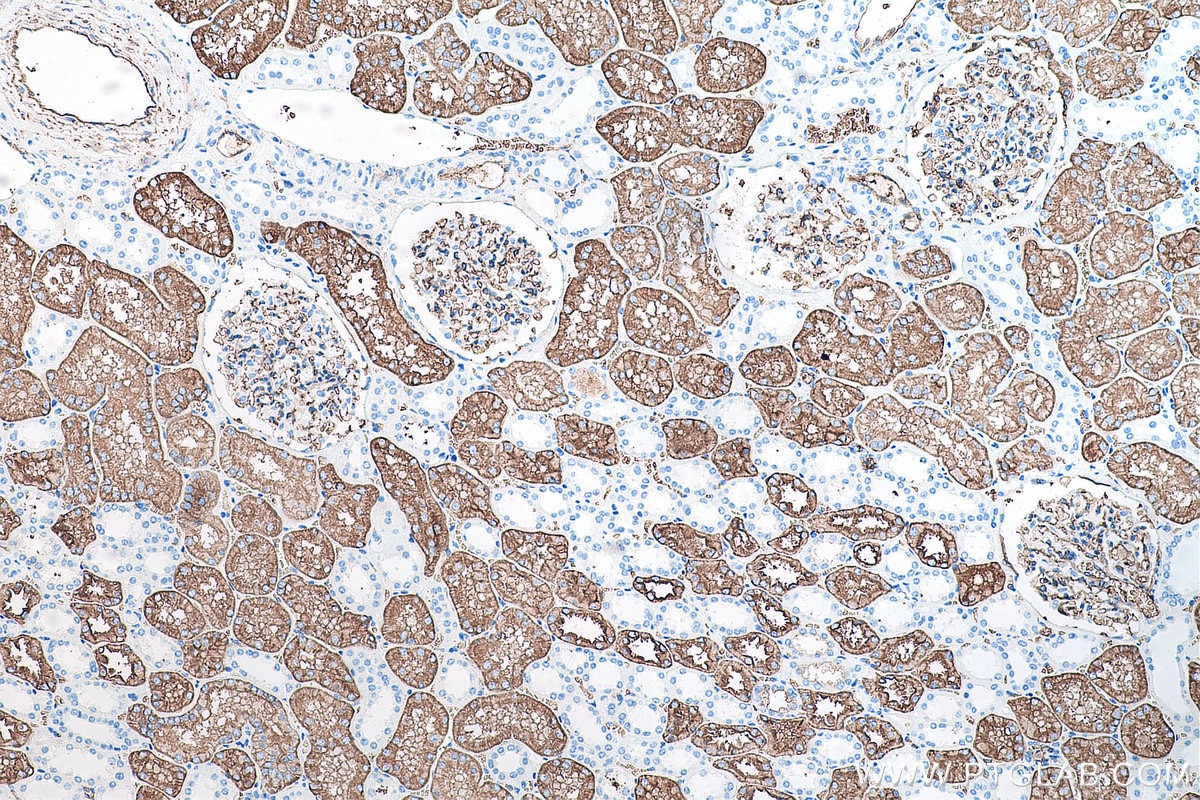 Immunohistochemistry (IHC) staining of human kidney tissue using AQP1 Polyclonal antibody (20333-1-AP)