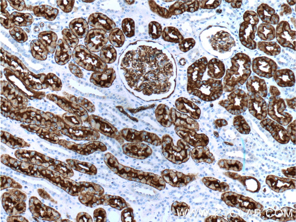 Immunohistochemistry (IHC) staining of human kidney tissue using AQP1 Polyclonal antibody (20333-1-AP)