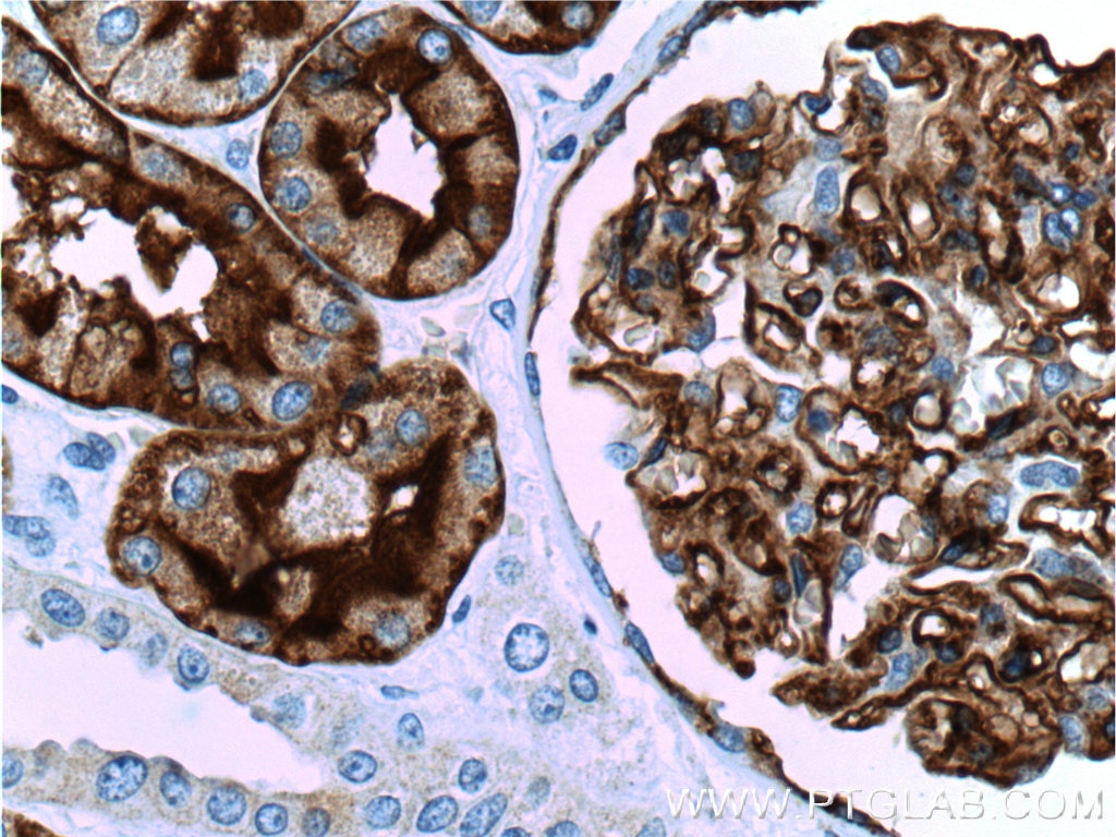 Immunohistochemistry (IHC) staining of human kidney tissue using AQP1 Polyclonal antibody (20333-1-AP)