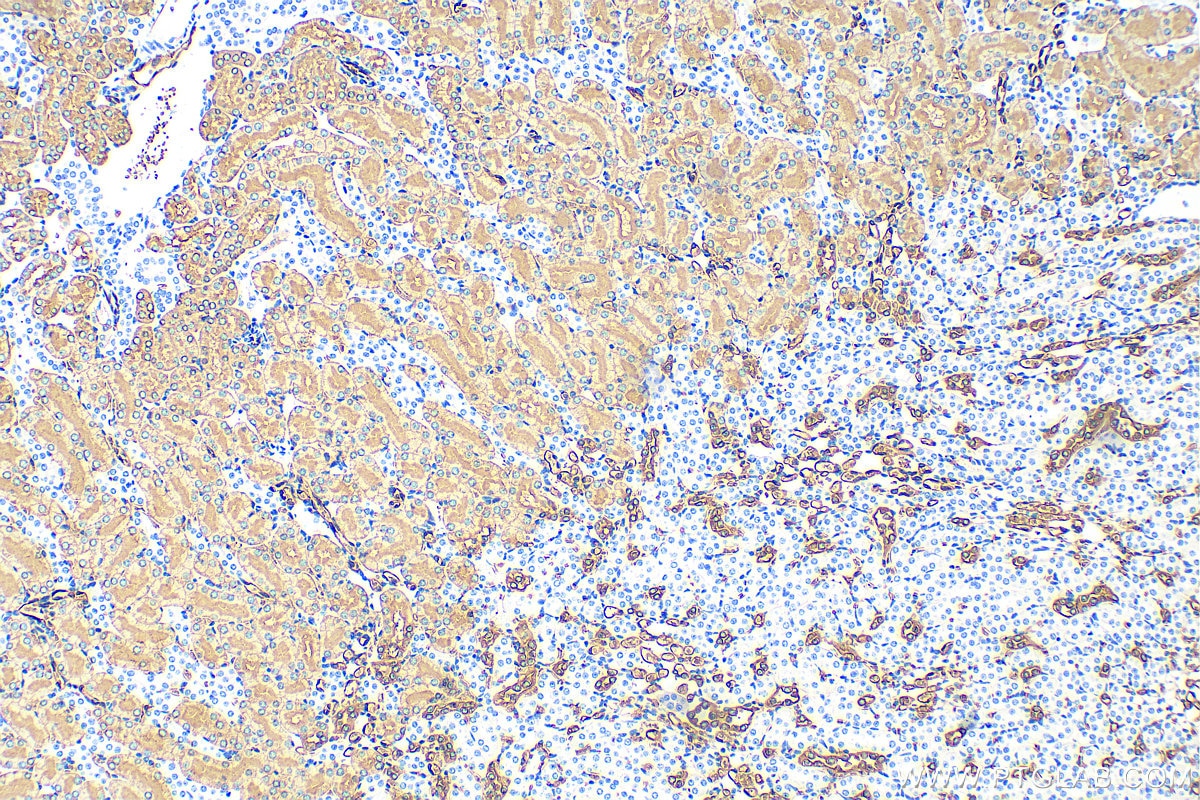 Immunohistochemistry (IHC) staining of mouse kidney tissue using AQP1 Polyclonal antibody (20333-1-AP)