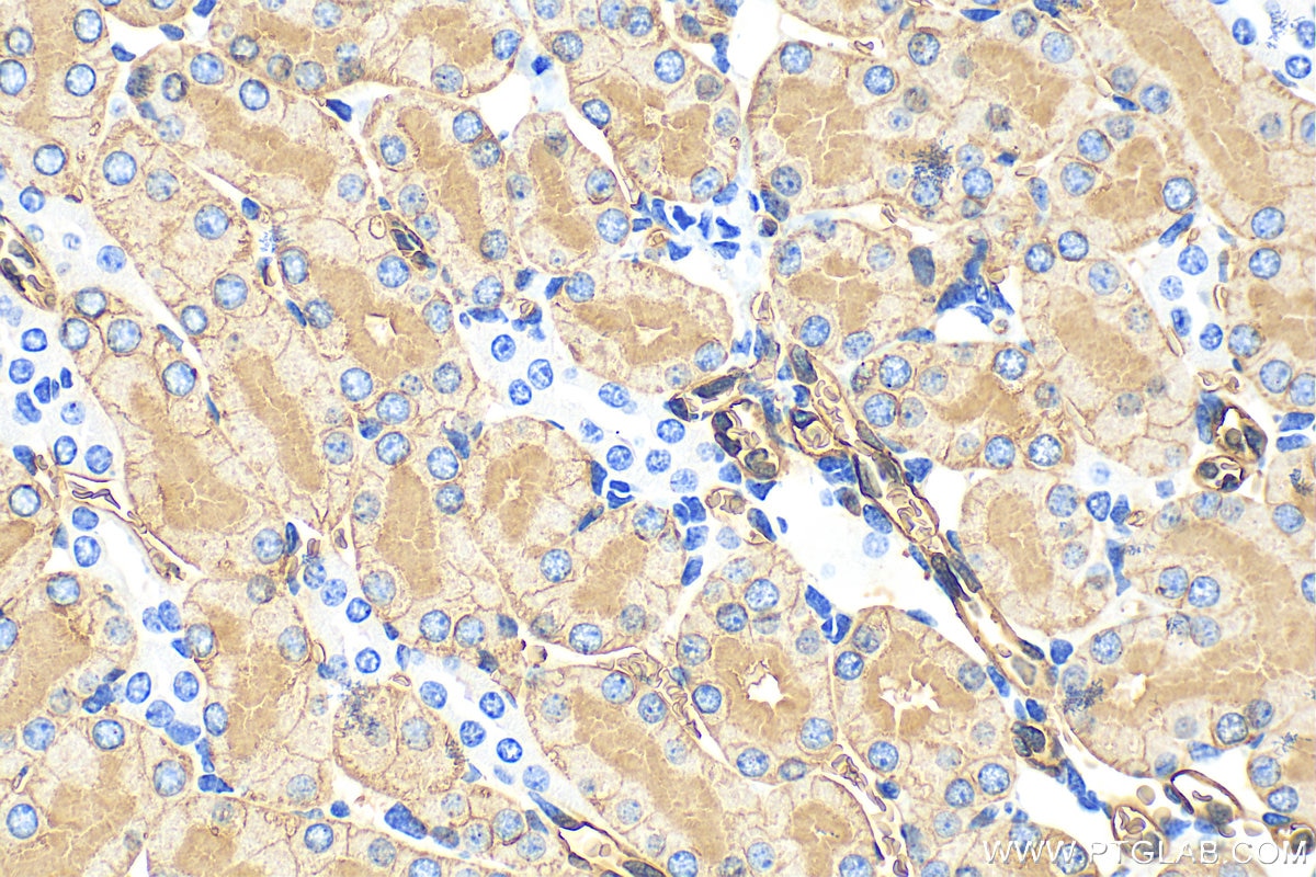 Immunohistochemistry (IHC) staining of mouse kidney tissue using AQP1 Polyclonal antibody (20333-1-AP)