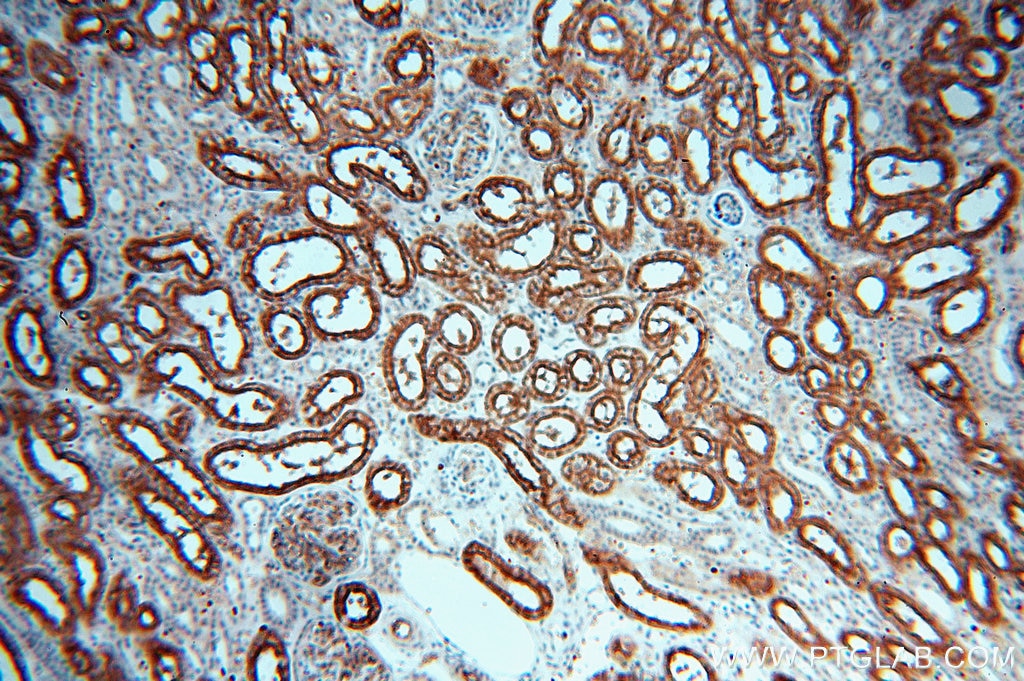 Immunohistochemistry (IHC) staining of human kidney tissue using AQP1 Polyclonal antibody (20333-1-AP)