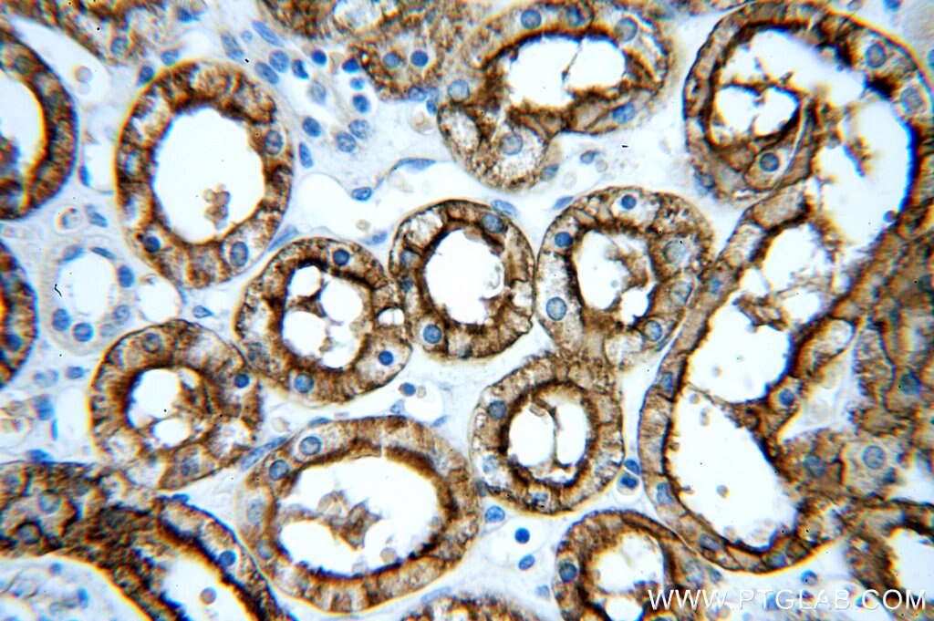 Immunohistochemistry (IHC) staining of human kidney tissue using AQP1 Polyclonal antibody (20333-1-AP)