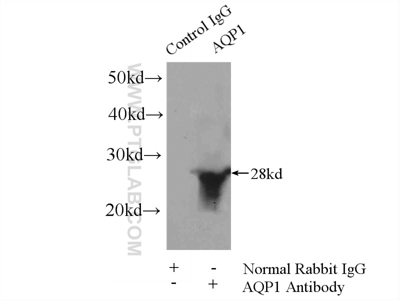 Immunoprecipitation (IP) experiment of mouse skeletal muscle tissue using AQP1 Polyclonal antibody (20333-1-AP)