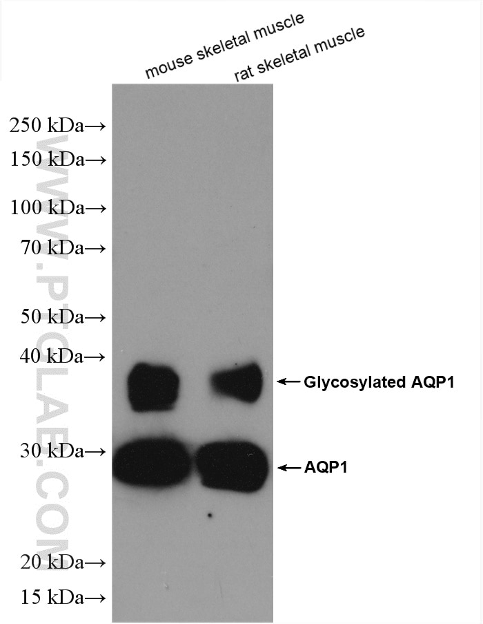 Western Blot (WB) analysis of various lysates using AQP1 Polyclonal antibody (20333-1-AP)
