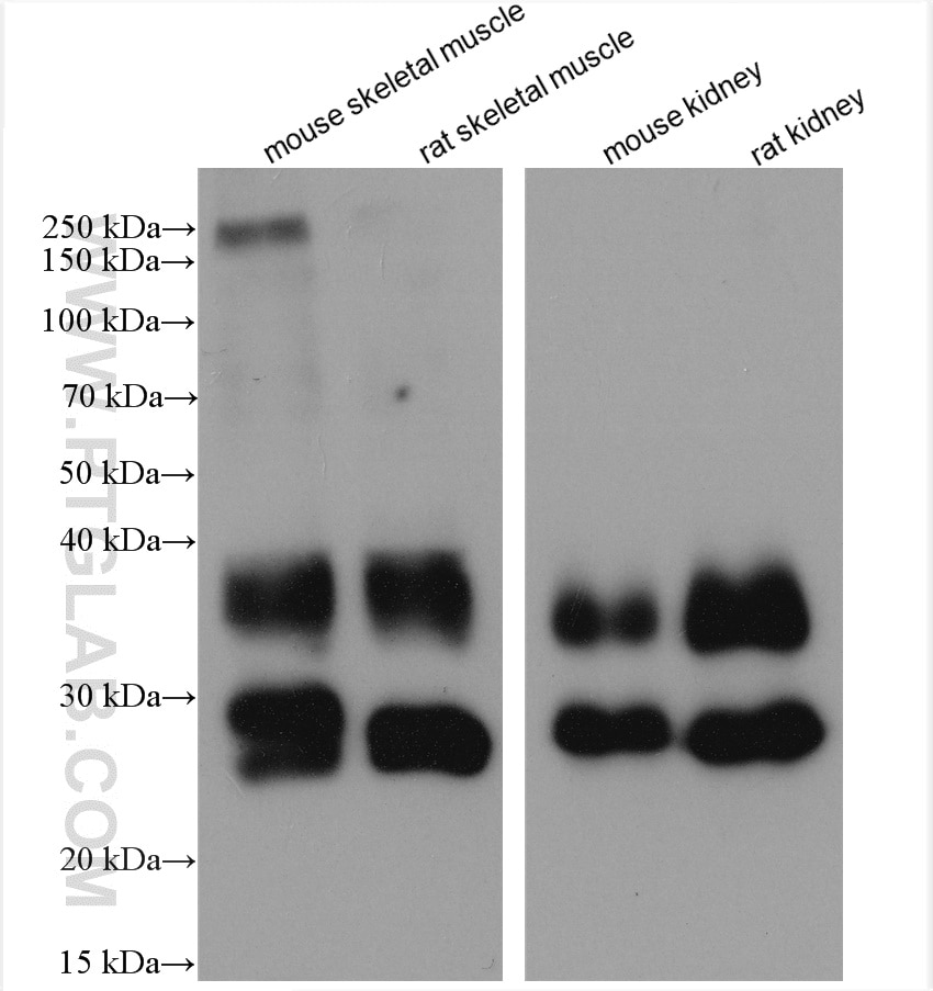 Western Blot (WB) analysis of various lysates using AQP1 Polyclonal antibody (20333-1-AP)