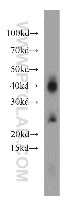 Western Blot (WB) analysis of human heart tissue using AQP1 Polyclonal antibody (20333-1-AP)