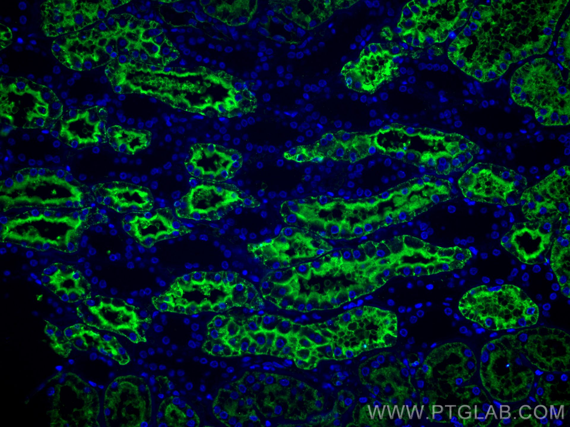 Immunofluorescence (IF) / fluorescent staining of human kidney tissue using AQP1 Monoclonal antibody (66805-1-Ig)