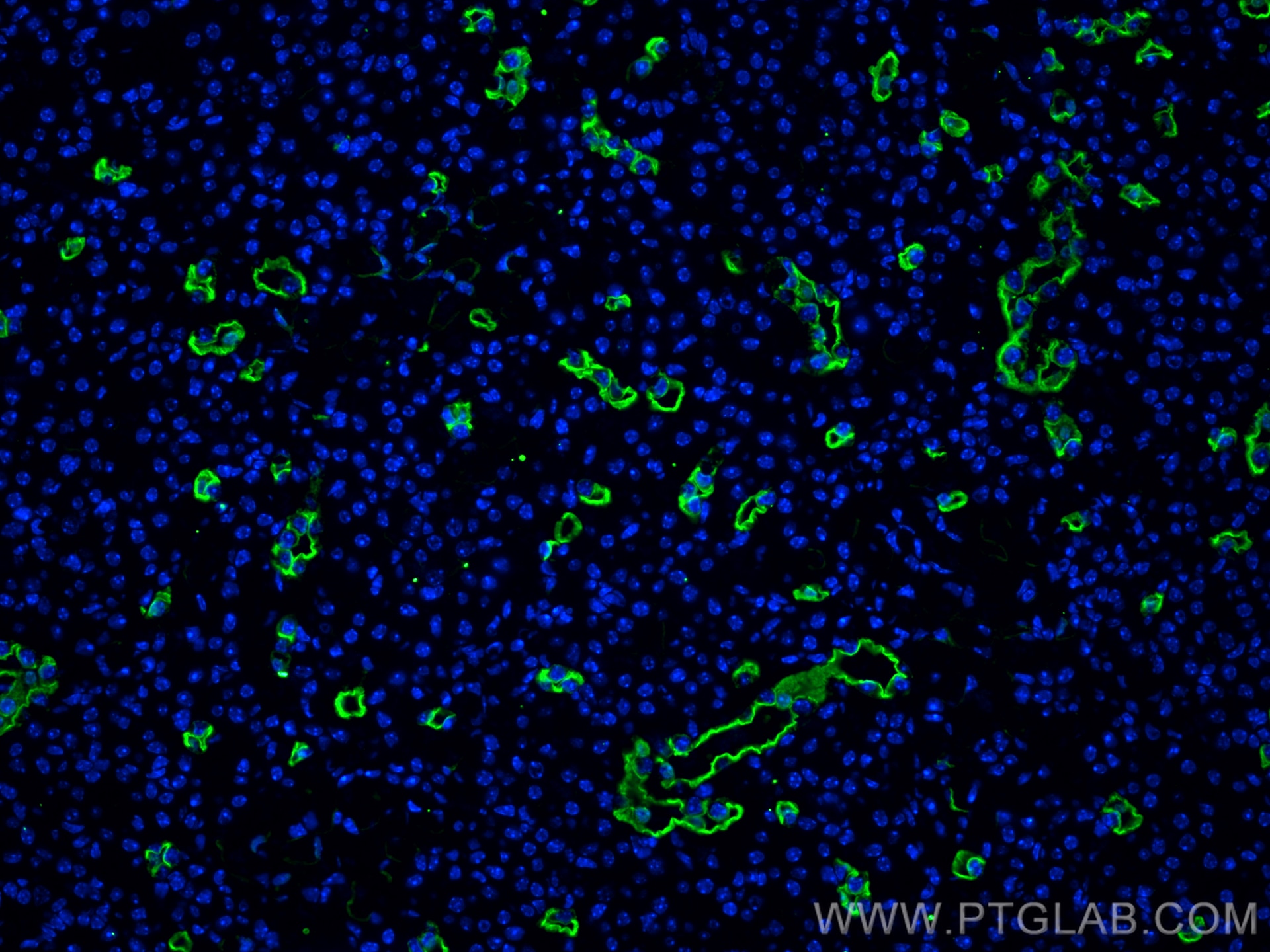 IF Staining of mouse kidney using 66805-1-Ig Immunofluorescence (IF) / fluorescent staining of mouse kidney tissue using AQP1 Monoclonal antibody (66805-1-Ig)
