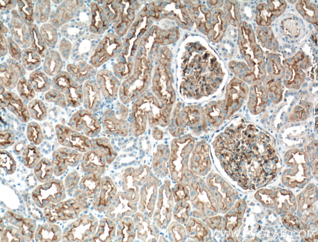 Immunohistochemistry (IHC) staining of human kidney tissue using AQP1 Monoclonal antibody (66805-1-Ig)