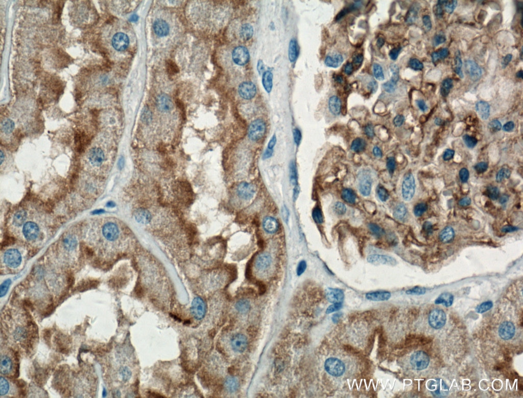 Immunohistochemistry (IHC) staining of human kidney tissue using AQP1 Monoclonal antibody (66805-1-Ig)