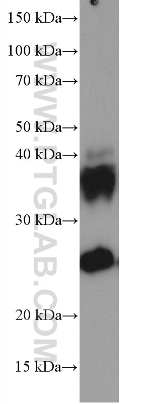 Western Blot (WB) analysis of human skeletal muscle tissue using AQP1 Monoclonal antibody (66805-1-Ig)