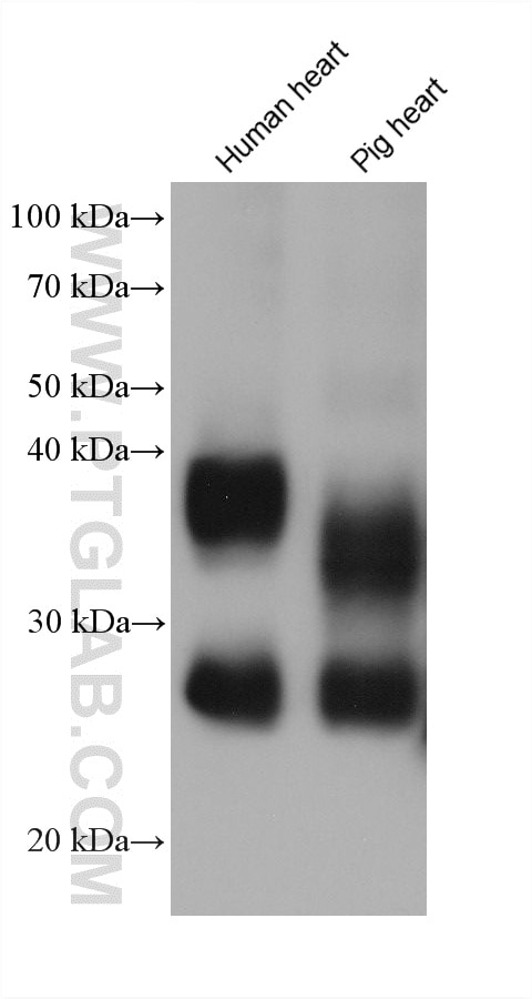 WB analysis using 66805-1-Ig Western Blot (WB) analysis of various lysates using AQP1 Monoclonal antibody (66805-1-Ig)